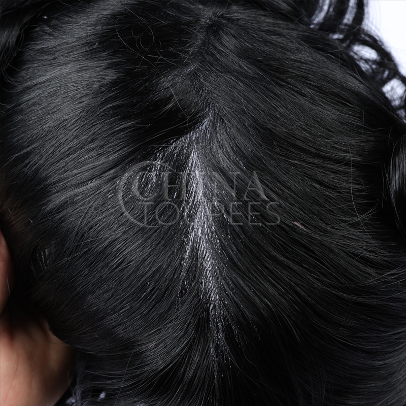 Injection toupee with lace front